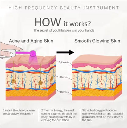 BloomLift™ High-Frequency Beauty Wand